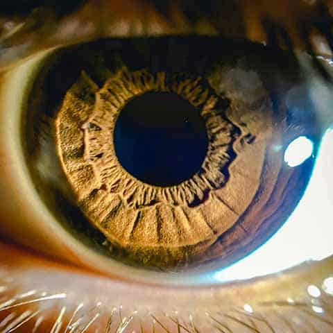 Close up of an eye and iris in relation to Glaucoma & Macular Degeneration