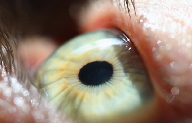 Close up eye and iris relating to Vitreous Retinal at Sapphire Eye Care
